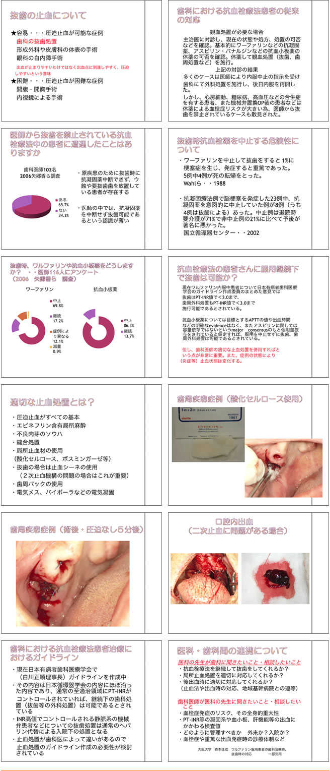 抗血栓療法の功罪について 理事長講演内容より抜粋